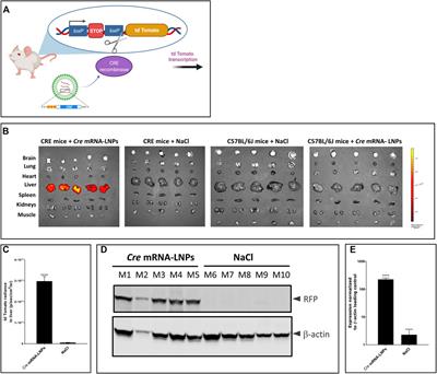 Phenylalanine hydroxylase mRNA rescues the phenylketonuria phenotype in mice